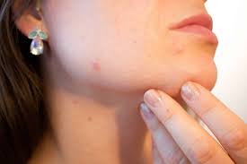skin care कैसे करें ( complete skincare for all skin type) skin care कैसे करें ( complete skincare for all skin type)