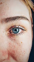 glowing skin tips in Hindi