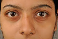 glowing skin tips in Hindi