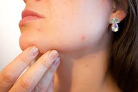 glowing skin tips in Hindi